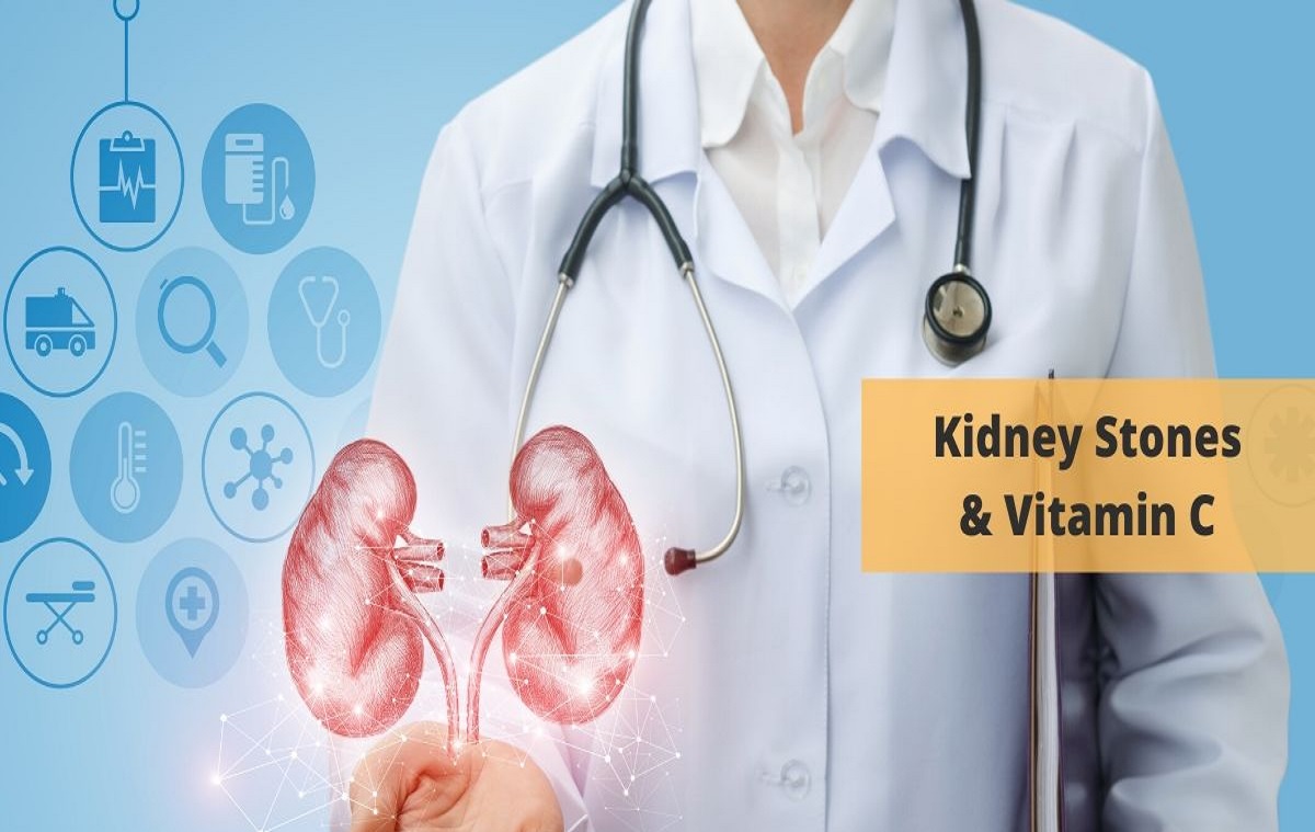 The Link Between Vitamin C and Kidney Stones The Ultimate Guide I